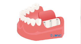 診断・治療計画の作成