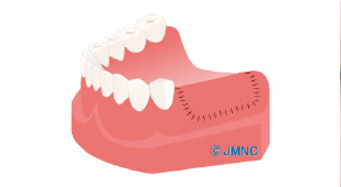 診断・治療計画の作成