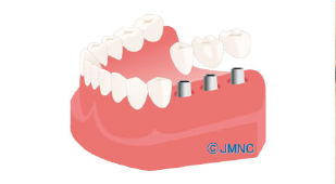 診断・治療計画の作成