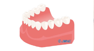 診断・治療計画の作成