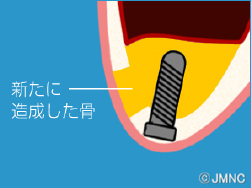 診断・治療計画の作成