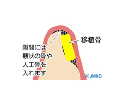 診断・治療計画の作成
