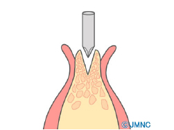 診断・治療計画の作成