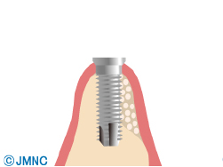 診断・治療計画の作成